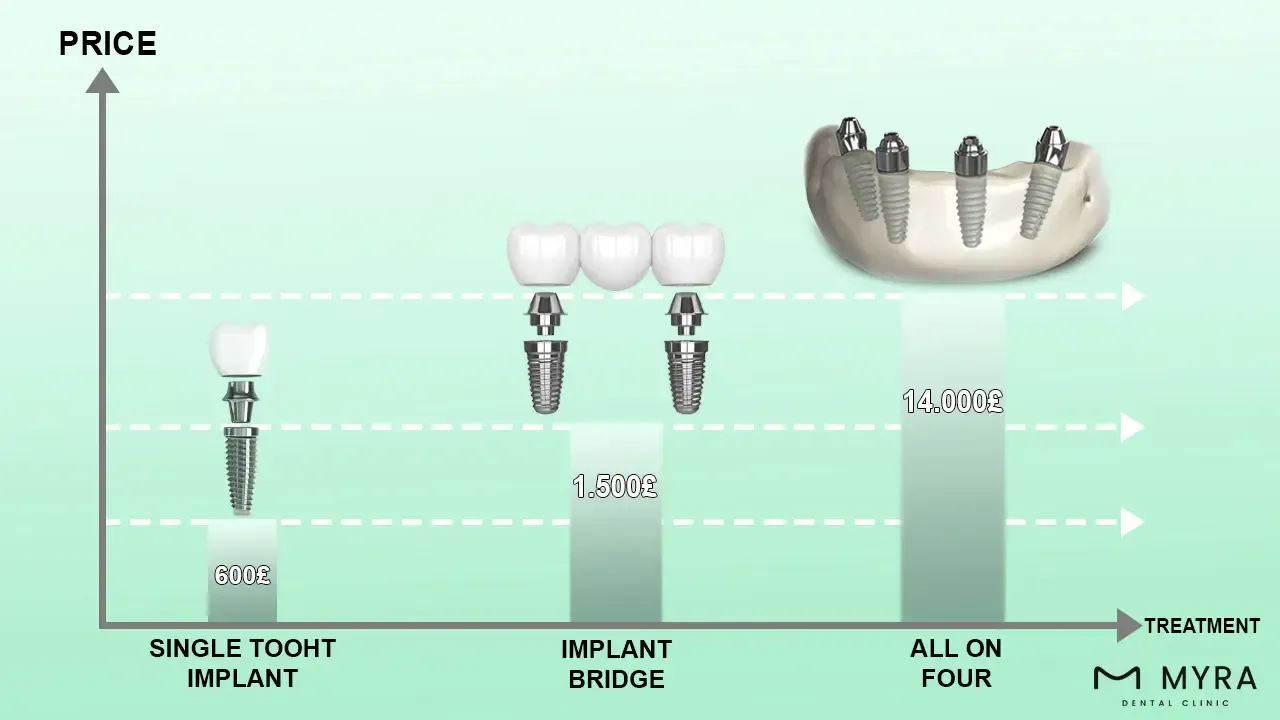 How Much is the Average Cost of Immediate Load Dental Implants_.webp